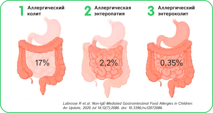 IgE механизм