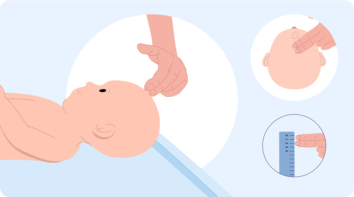 Baby rodnichok checkup