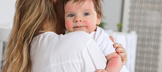 Какова роль питания в первичной профилактике аллергических заболеваний у детей?