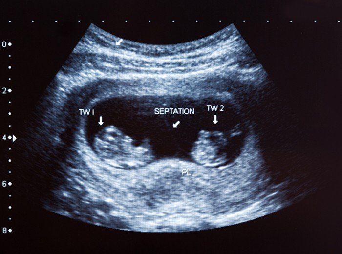 Как происходит развитие эмбриона человека