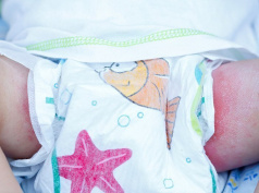  Раздражения от подгузников: пеленочный дерматит, потница и опрелости новорожденных
